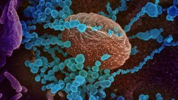 coronavirus