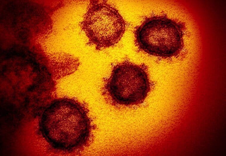 coronavirus